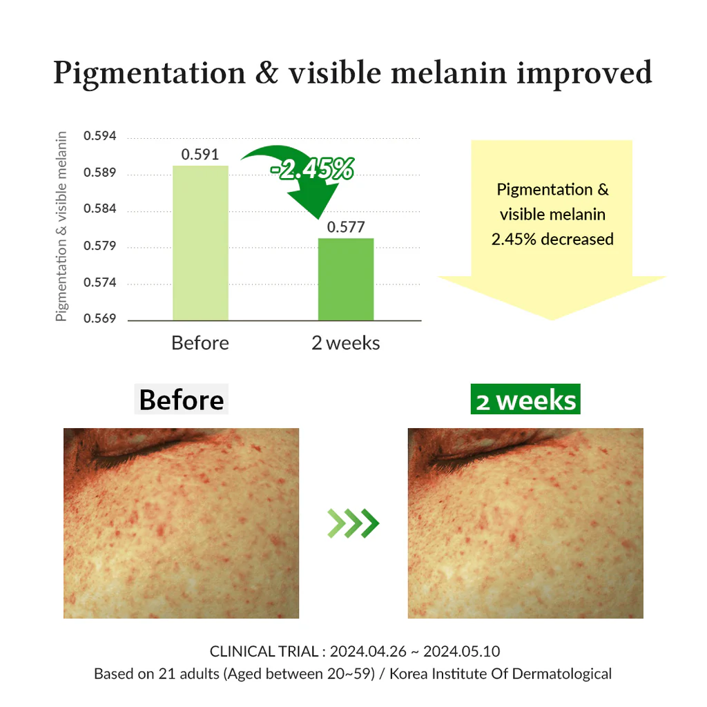 Dr.Althea Gentle Vitamin C Serum 30 ml - Image 4